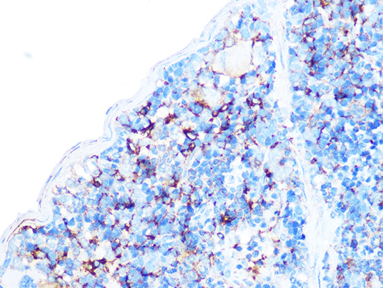 Arp3 Rabbit monoclonal antibody