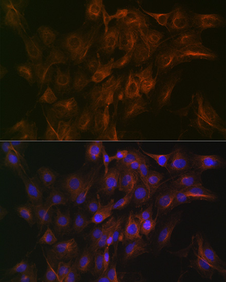 Arp3 Rabbit monoclonal antibody