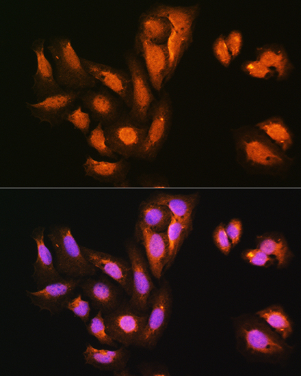 KIFAP3 Rabbit polyclonal antibody