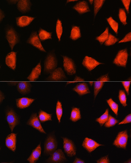 KIFAP3 Rabbit polyclonal antibody