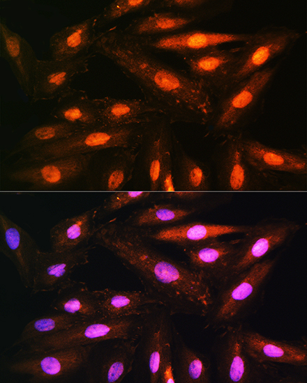 KIFAP3 Rabbit polyclonal antibody