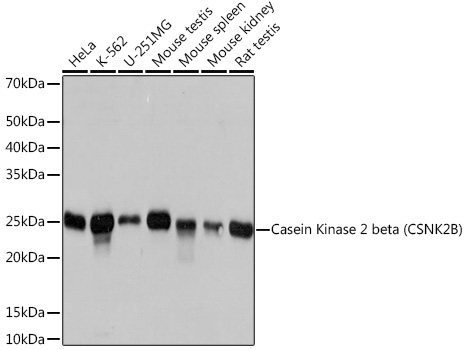 Casein Kinase 2 beta (CSNK2B) Rabbit monoclonal antibody