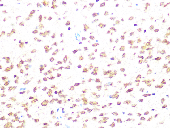 Casein Kinase 2 beta (CSNK2B) Rabbit monoclonal antibody