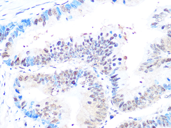 Casein Kinase 2 beta (CSNK2B) Rabbit monoclonal antibody