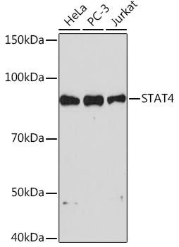 STAT4 Rabbit monoclonal antibody