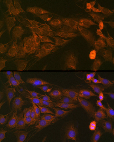 STAT4 Rabbit monoclonal antibody