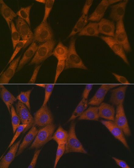 STAT4 Rabbit monoclonal antibody