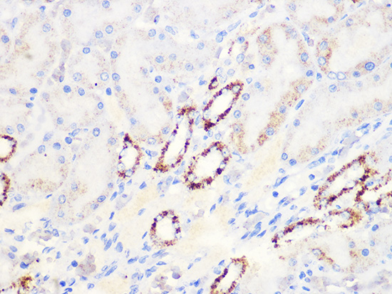 Aconitase 2 (ACO2) Rabbit monoclonal antibody