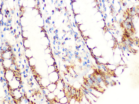 Aconitase 2 (ACO2) Rabbit monoclonal antibody