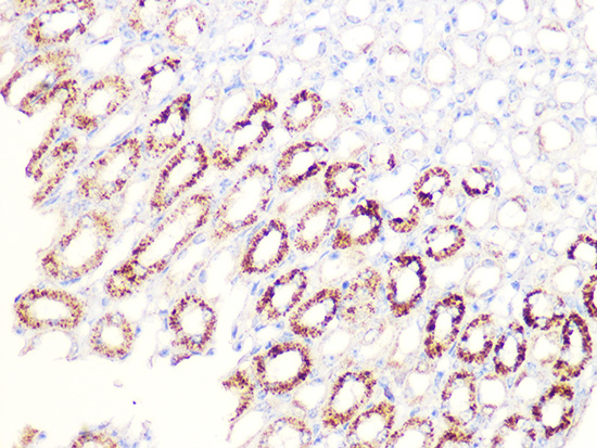 Aconitase 2 (ACO2) Rabbit monoclonal antibody