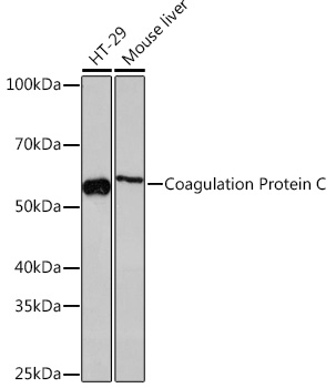 Coagulation Protein C Rabbit monoclonal antibody