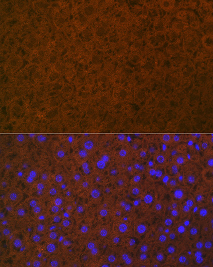 Coagulation Protein C Rabbit monoclonal antibody
