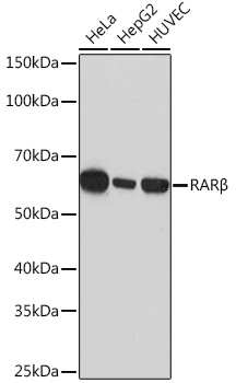 RARB Beta Rabbit monoclonal antibody