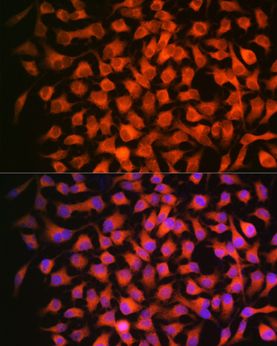 RARB Beta Rabbit monoclonal antibody