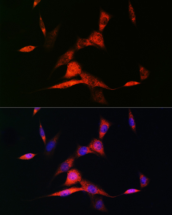 RARB Beta Rabbit monoclonal antibody