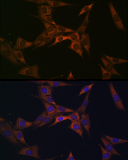 BMP6 Rabbit monoclonal antibody
