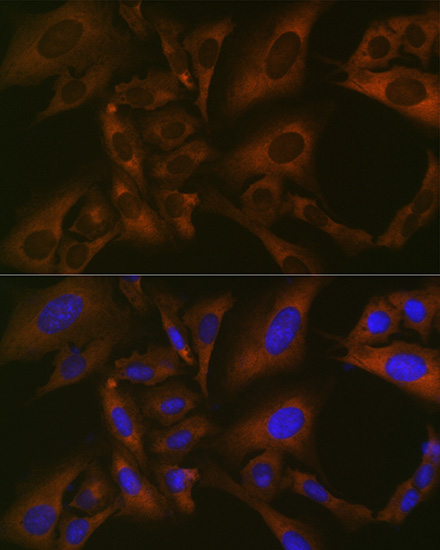 BMP6 Rabbit monoclonal antibody