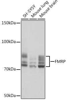 FMRP Rabbit monoclonal antibody