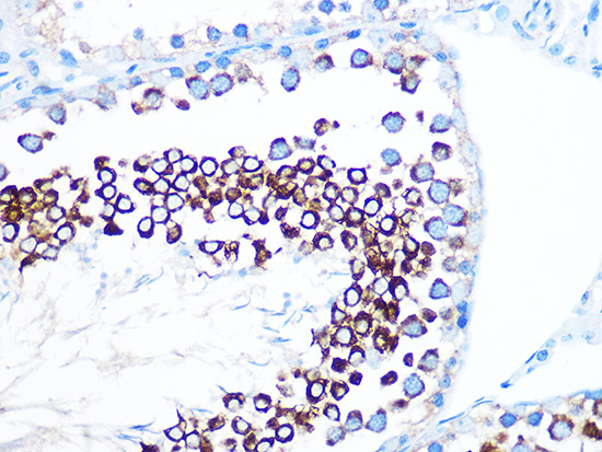 FMRP Rabbit monoclonal antibody