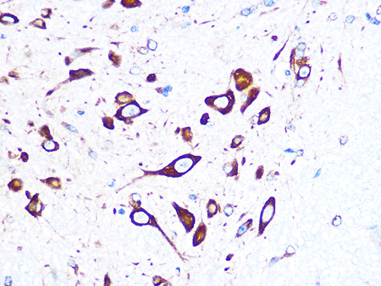 FMRP Rabbit monoclonal antibody