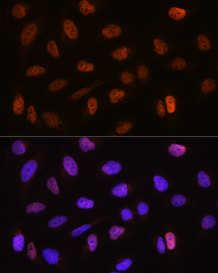 CSTF2T Rabbit polyclonal antibody
