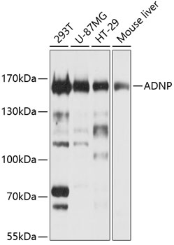 ADNP Rabbit polyclonal antibody