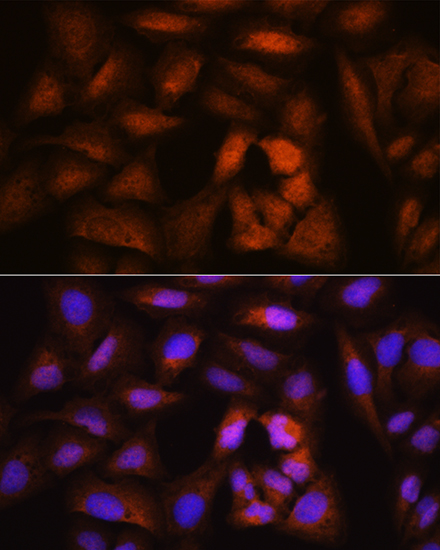 NCAPH Rabbit polyclonal antibody