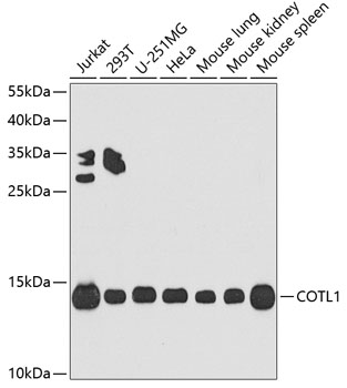 COTL1 Rabbit polyclonal antibody