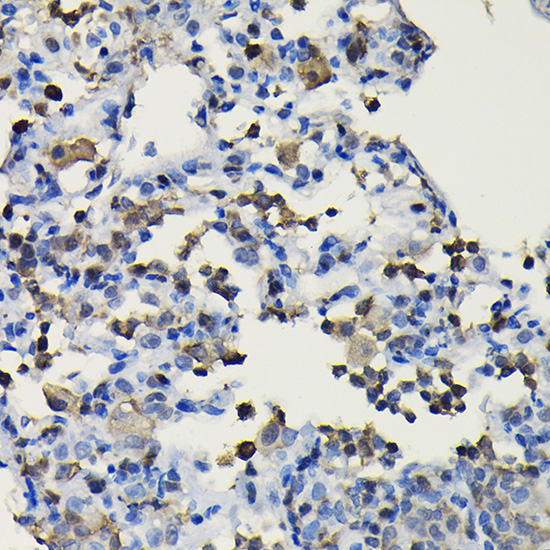 COTL1 Rabbit polyclonal antibody
