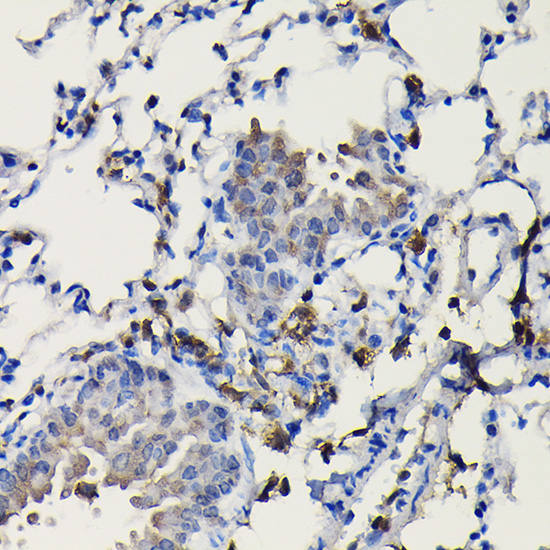 COTL1 Rabbit polyclonal antibody
