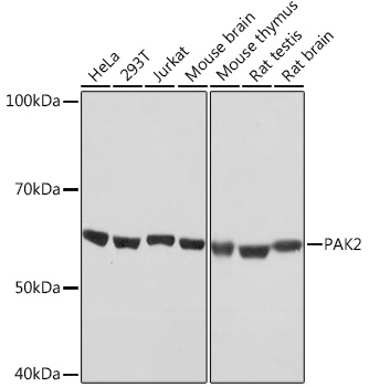PAK2 Rabbit monoclonal antibody
