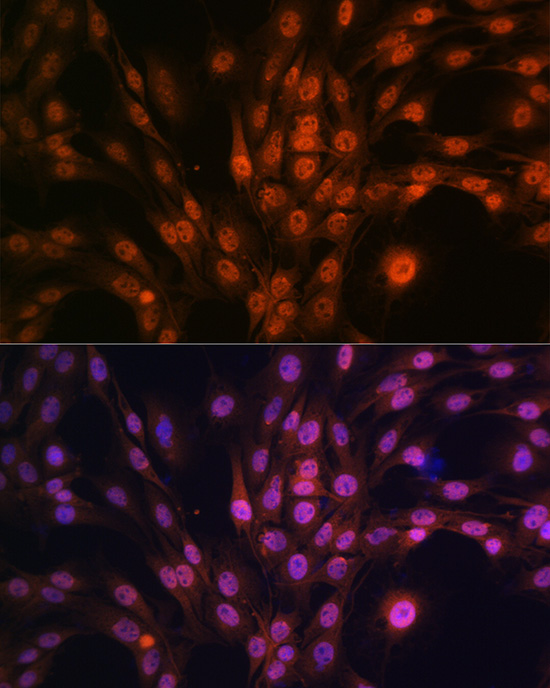 PAK2 Rabbit monoclonal antibody