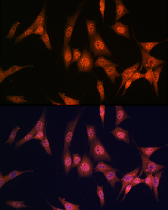PAK2 Rabbit monoclonal antibody