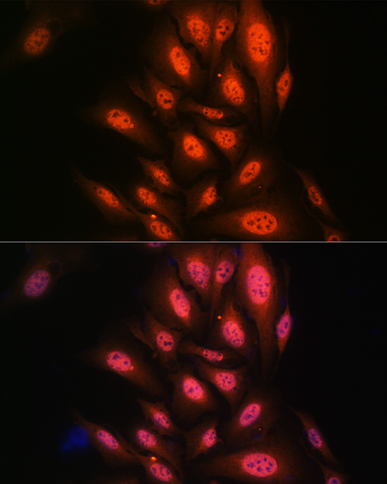 PAK2 Rabbit monoclonal antibody