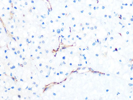 PODXL Rabbit monoclonal antibody