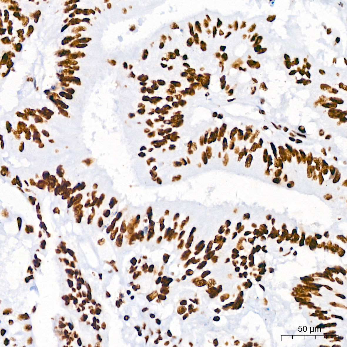 DHX9/RNA Helicase A Rabbit monoclonal antibody