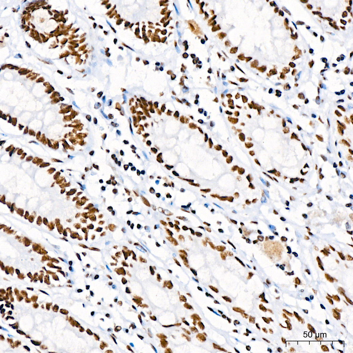DHX9/RNA Helicase A Rabbit monoclonal antibody