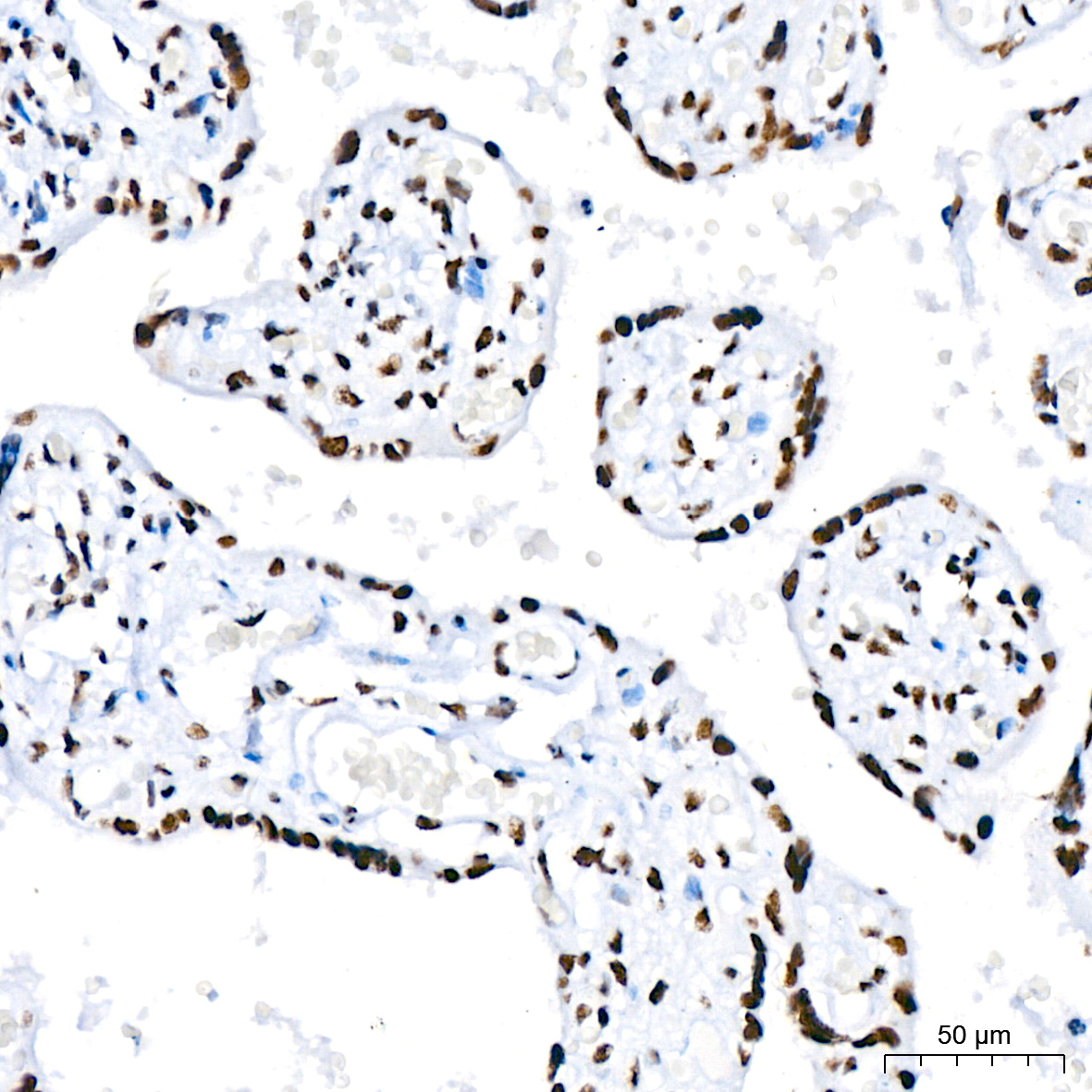 DHX9/RNA Helicase A Rabbit monoclonal antibody