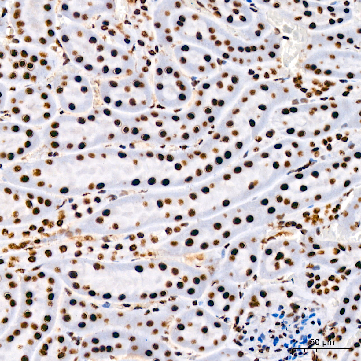 DHX9/RNA Helicase A Rabbit monoclonal antibody