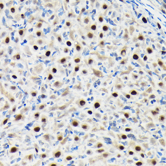 GTPBP4 Rabbit polyclonal antibody