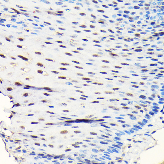 GTPBP4 Rabbit polyclonal antibody