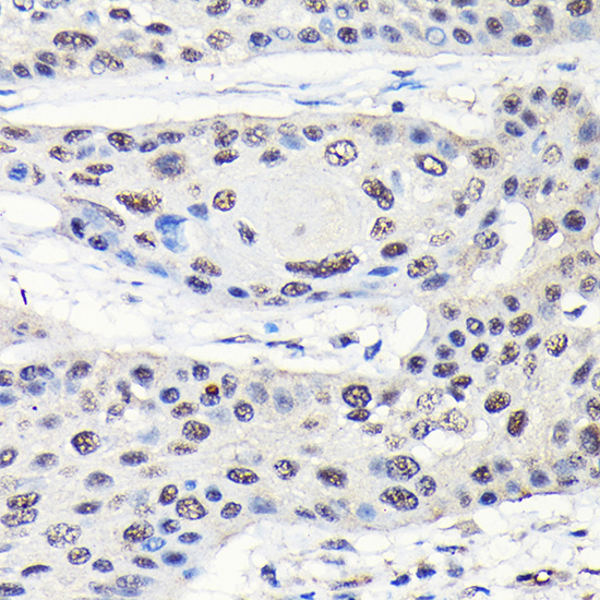 GTPBP4 Rabbit polyclonal antibody