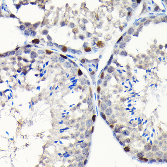 GTPBP4 Rabbit polyclonal antibody