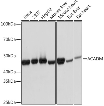 ACADM Rabbit monoclonal antibody