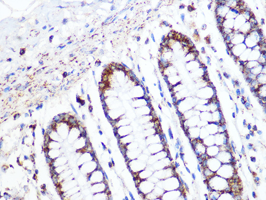 ACADM Rabbit monoclonal antibody