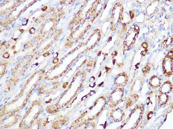 ACADM Rabbit monoclonal antibody