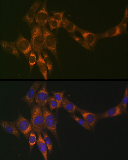 ACADM Rabbit monoclonal antibody