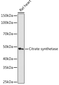 Citrate synthetase Rabbit monoclonal antibody