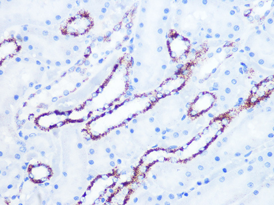 Citrate synthetase Rabbit monoclonal antibody