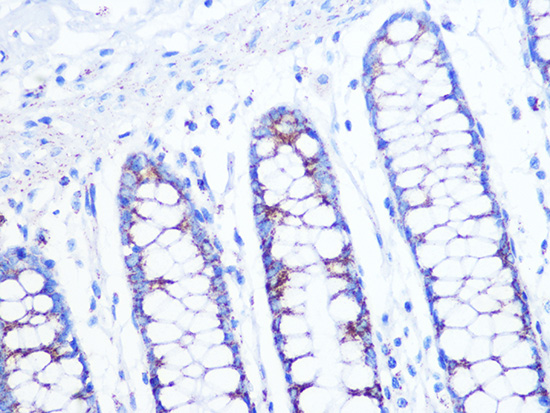 Citrate synthetase Rabbit monoclonal antibody